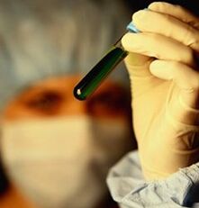 kaip išsitirti dėl parazitų