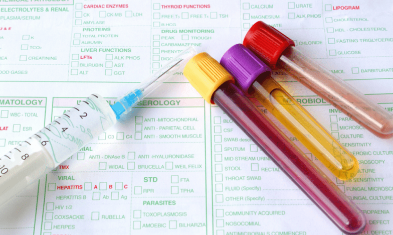 parazitų organizme diagnostikos galimybės