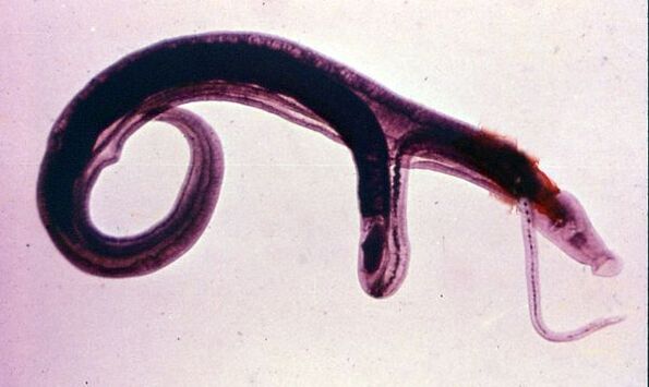 Šistosomos yra vienas iš labiausiai paplitusių ir pavojingiausių parazitų